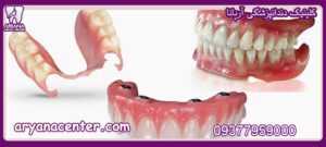 پروتز دندان کلینیک دندانپزشکی آریانا