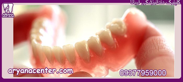 پروتز دندان متحرک کلینیک دندانپزشکی آریانا