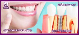 ترمیم پروتز دندان و ایمپلنت دندان